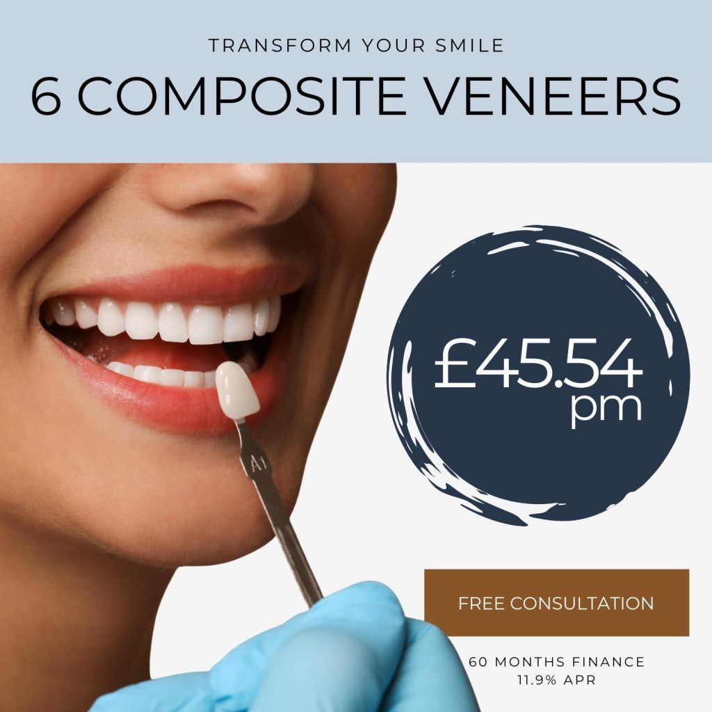 composite veneer finance